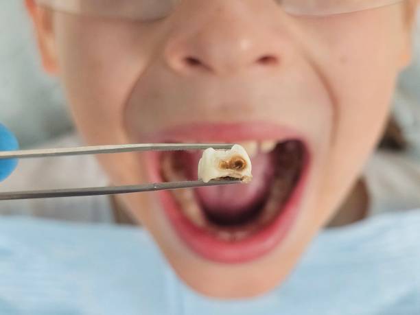Best Emergency Pediatric Dentist  in North Scituate, MA